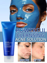 RAPID CLEAR KOREAN MUD MASK- DEEP CLEANING-PORE TIGHTENIN -EXFOLIATING-