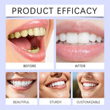BRIGHT PURPLE SMILE WHITENING STRIPS KIT