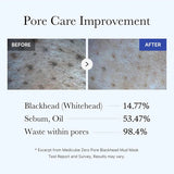 RAPID CLEAR KOREAN MUD MASK- DEEP CLEANING-PORE TIGHTENIN -EXFOLIATING-